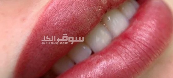 مايكروبليدج - 2